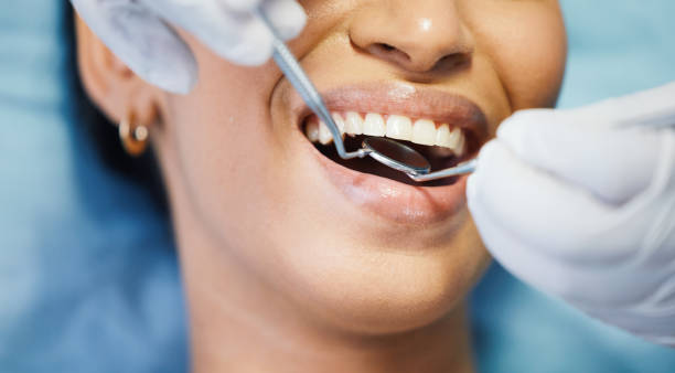 Best Emergency Dental Care for Broken or Chipped Teeth in Lady Lake, FL