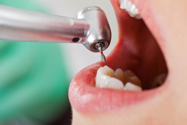 Best Pediatric Emergency Dentist in Lady Lake, FL